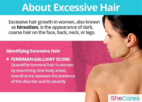 Excessive Hair Shecares