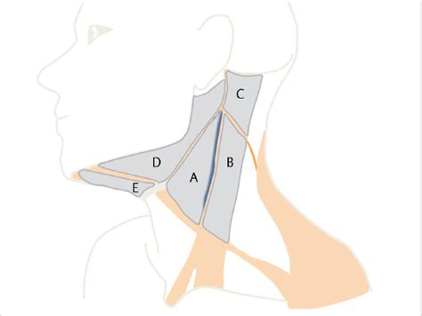Neck Dissection Levels I To Iii Supraomohyoid Dissection Ento Key