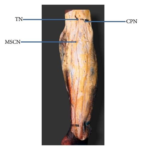 Both Peroneal Communicating Nerve And Lateral Sural Cutaneous Nerve Are