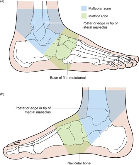 Figure 1 From Soft Tissue Ankle Injuries Semantic Scholar