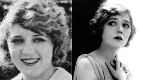 11 Classic Hollywood Stars Who Had Plastic Surgery ~ Vintage Everyday