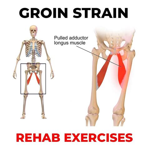 Call it what you want, the fact a groin pull or strain specifically affects the adductor muscles. James Lu - RMT 🇨🇦 TO on Instagram: "🚨 3 EXERCISES FOR ...