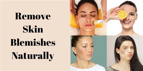 Skin Blemishes Types And Ways To Remove Skin Blemishes Naturally