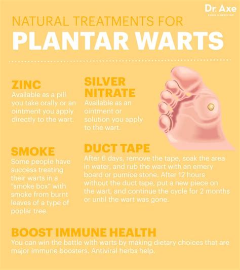 Natural Remedies For Planters Warts Rumah Melo