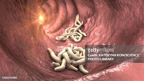 Enterobius Vermicularis Fotografías E Imágenes De Stock Getty Images