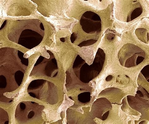 Bone Tissue Sem Photograph By Steve Gschmeissner Fine Art America