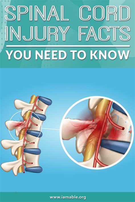Spinal Cord Injury Facts You Need To Know