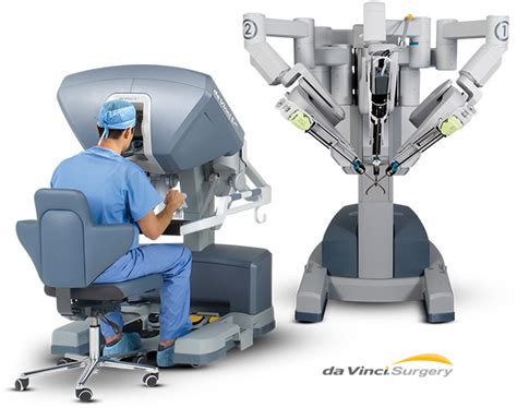 Single Incision Robotic Gallbladder Removal Beverly Hills
