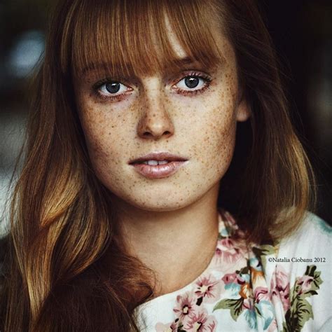 Freckles Photo Contest Winners Viewbug Com