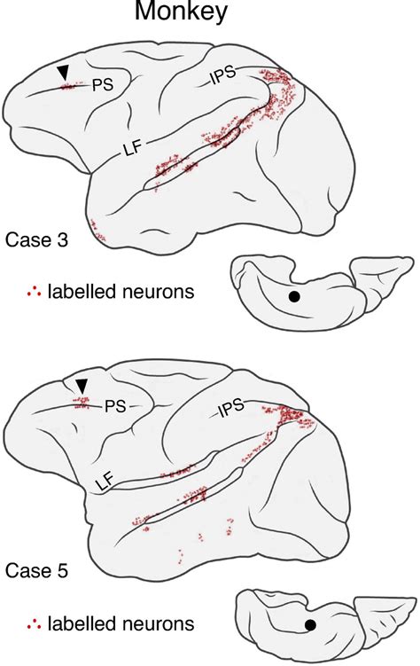 Side By Side Regions In Dorsolateral Prefrontal Cortex Estimated Within