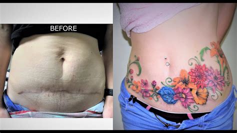 Cover Up Belly Scars And Stretch Marks Youtube