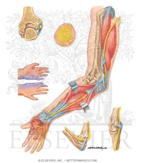 Compression Of Ulnar Nerve