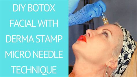 Diy Botox Facial With Derma Stamp Microneedling Youtube