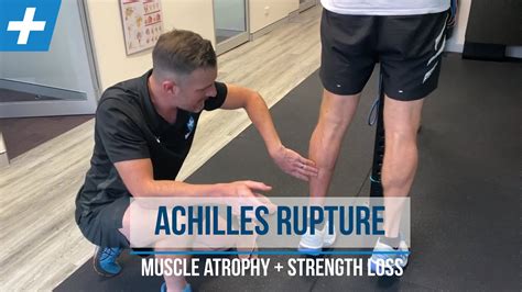 Achilles Rupture Rehab Calf Muscle Atrophy And Strength Loss Tim Keeley Physio Rehab Youtube