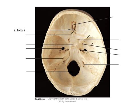Fig 910 Superior View Of Floor Of Cranial Cavity Diagram Quizlet