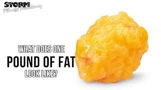 20 Lbs Of Fat Looks Like SkinTots