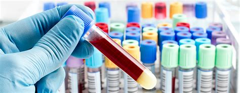 Why did you become a phlebotomist? Phlebotomy Aide - Adult & Career Technical Education