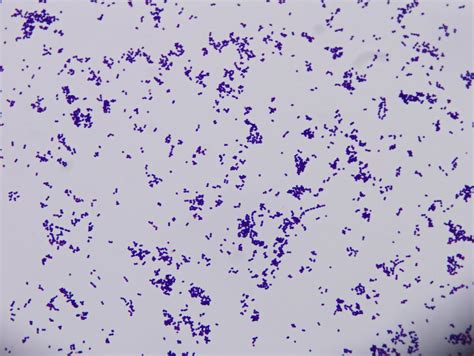 Streptococcus Gram Stain Morphology