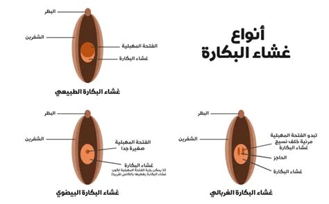 كيف اعرف ان غشاء البكاره موجود أفكار الحدائق