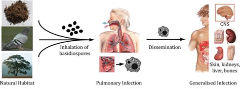 Schematic Pathogenesis Of Cryptococcal Disease Infection Is Believed