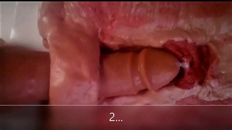 Close Up And Internal View Of Anal Dildo Fucking Xvideos