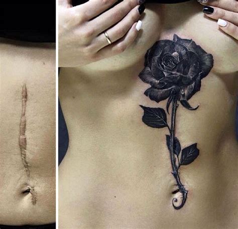 clever tattoo designs that turn scars into beautiful works of art