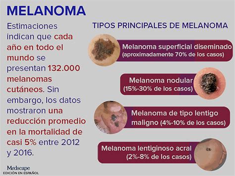 Tendencia Clínica Melanoma