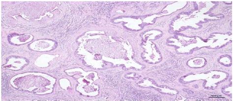 Scielo Brasil Tubulopapillary Rectal Adenocarcinoma In Dog