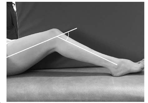 Examination Position Of Knee Flexion Contracture By Using A Goniometer