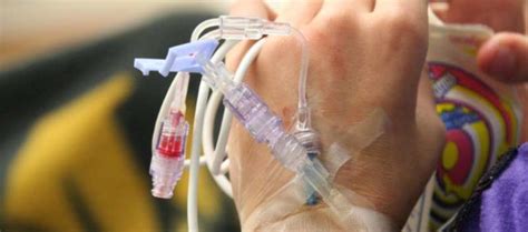 Durvalumab Plus Chemotherapy Improves Overall Survival In Extensive