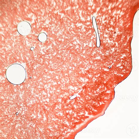 Blutausstrich Unter Dem Mikroskop Zeigt Neutrophile Und Rote