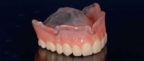 Dental Labs For Dentures In Arizona Conventional Full And Partial