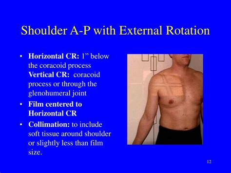 Ppt 141 Shoulder Radiography Powerpoint Presentation Free Download