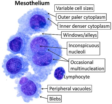 Mesothelium Wikipedia