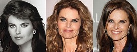 Maria Shriver Plastic Surgery Before and After Pictures 2023