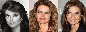 Maria Shriver Plastic Surgery Before and After Pictures 2023