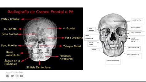 Anatomía Radiológica Youtube