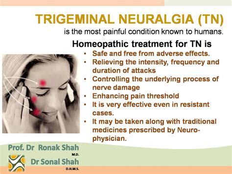 Trigeminal Neuralgia A Complete Guide Trigeminal Neuralgia Causes