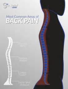 A backbone may interconnect different local area networks in offices, campuses or buildings. Most Common Back Pain Areas