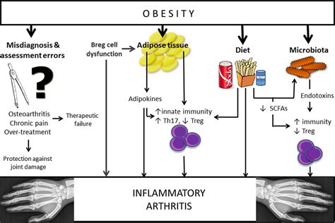 Obesity And Inflammatory Arthritis Impact On Occurrence Disease