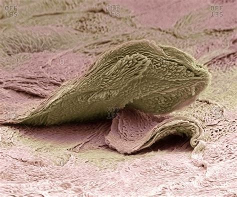 Skin Cell Under A Color Scanning Electron Micrograph Of A Squamous Cell
