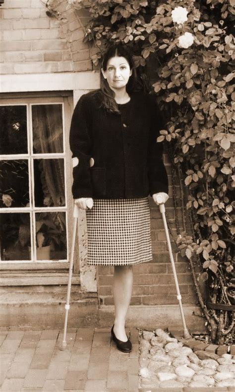 Jolanda Beautiful Woman Amputee Leg Crutches