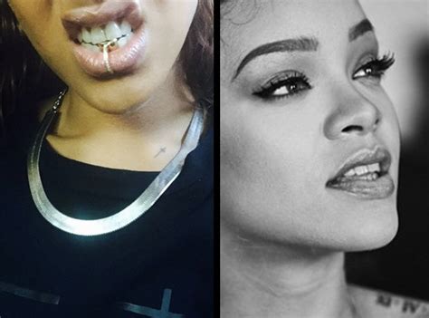 kanye west gold teeth