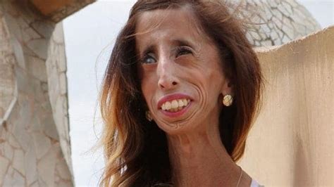 Lizzie Velasquez Why I’m Not The ‘the Ugliest Woman In The World’
