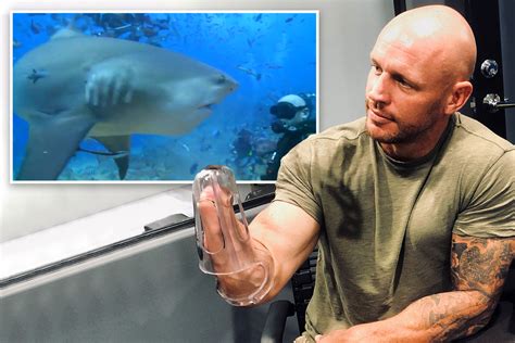 Shark Attack Leg Shark Attacks 65 Year Old Man Leaving Him With