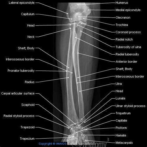 Radiological Anatomy Of The Shoulder Arm Elbow Forearm Wrist Hand