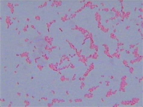 Gram Negative Bacilli With Safety Pin Appearance On Gram Stain