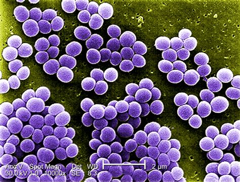 They are gram positive bacteria that are small round in shape (cocci) and occur as clusters appearing like a bunch of grapes on electron microscopy. Free picture: high, magnification, 10000x, strain ...