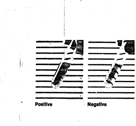 Figure 1 From Modified Sickledex Tube Test A Specific Test For S