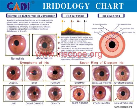 Sclerology Chart Free Iriscope Iridology Camera Iriscope Camera